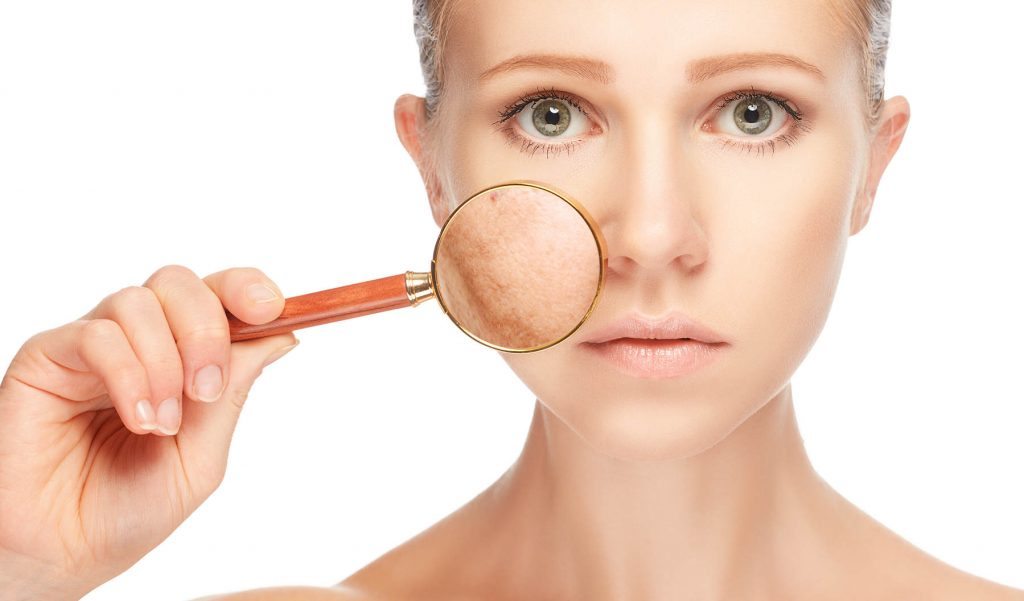 ¿Cómo eliminar las manchas de la piel de forma natural?