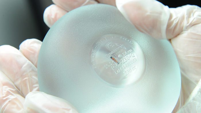 Se colocarán microchips en los implantes mamarios para evitar riesgos