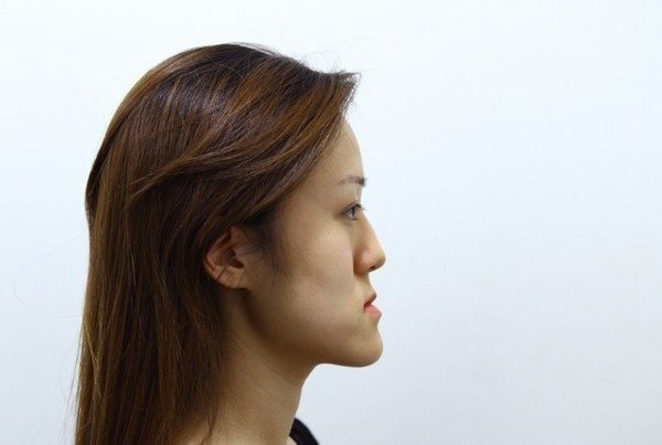 Gemelas coreanas transformadas por cirugía estetica