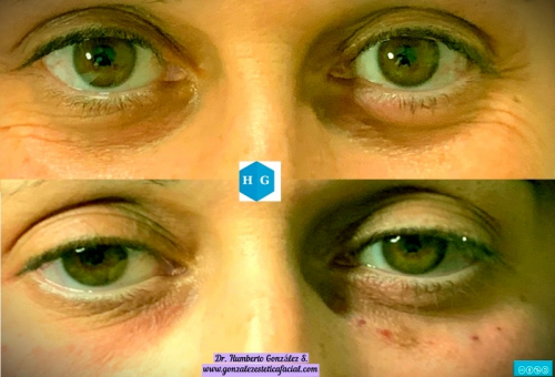 Foto Gonz�lezEst�ticaFacial (Centro Est�tico 2020)