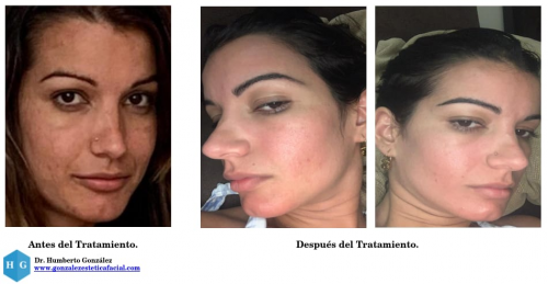 Foto Gonz�lezEst�ticaFacial (Centro Est�tico 2020)