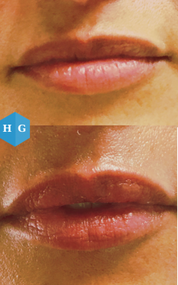 Foto Gonz�lezEst�ticaFacial (Centro Est�tico 2020)