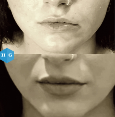 Foto Gonz�lezEst�ticaFacial (Centro Est�tico 2020)