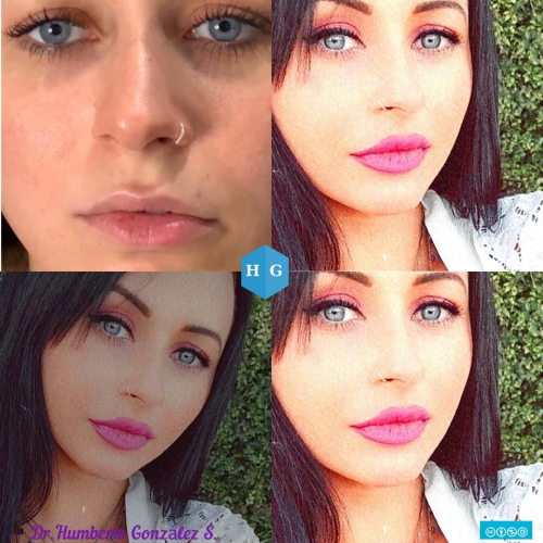 Foto Gonz�lezEst�ticaFacial (Centro Est�tico 2020)