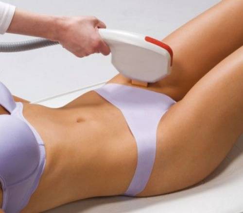 Foto Centro de est�tica Avanzada Platinum