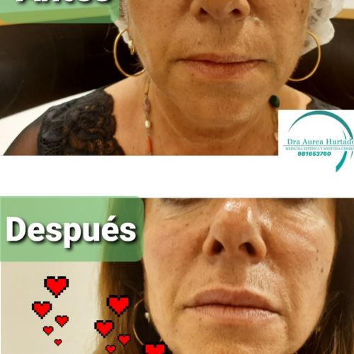 Foto Clinica Aurea Hurtado