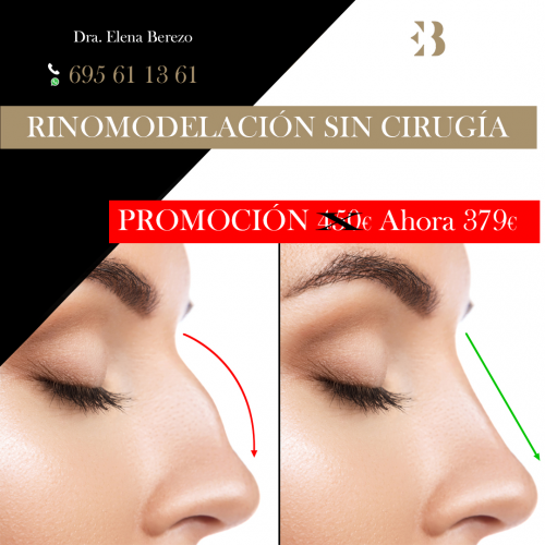 Rinomodelaci�n sin cirug�a