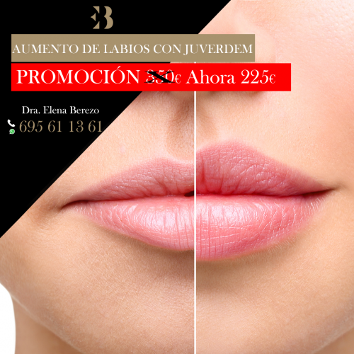 Aumento de Labios