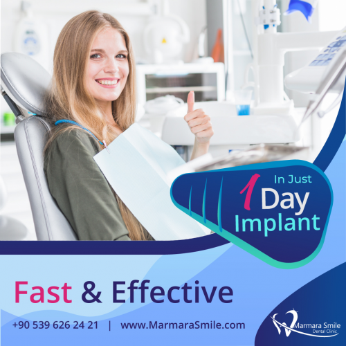 in-just-1-day-dental-implant-service