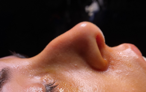 Rinoplastia ultras�nica