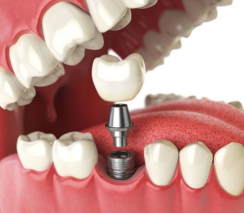 Foto Vellore Woods Dentistry