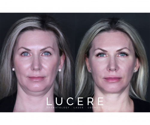 Foto Lucere Dermatology and Laser Clinic