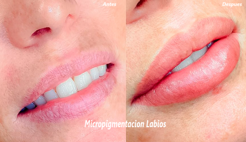 Foto Criden Magic Skin