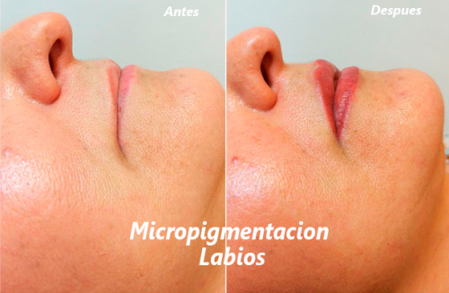 Foto Criden Magic Skin