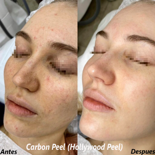 Foto Criden Magic Skin