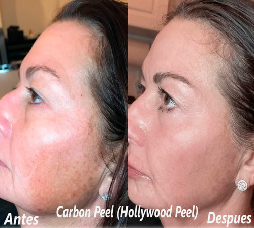 Foto Criden Magic Skin