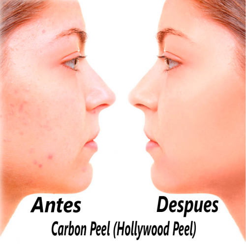 Foto Criden Magic Skin