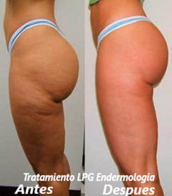 Foto Criden Magic Skin