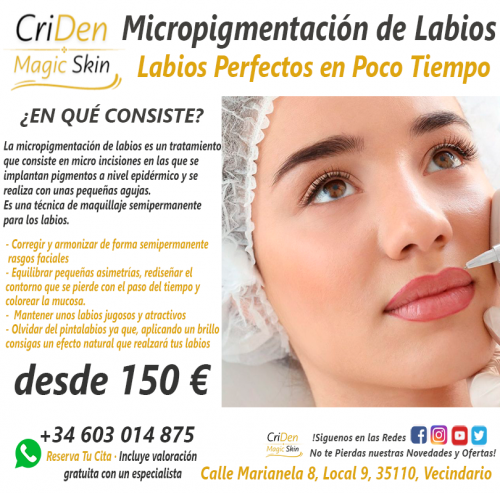 Foto Criden Magic Skin