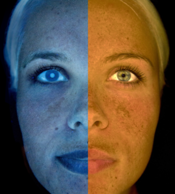 Diagnostico facial Malaga