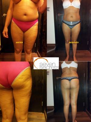 Foto Seven Secrets Tenerife