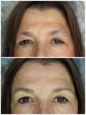 Cejas muy finas y sin forma.