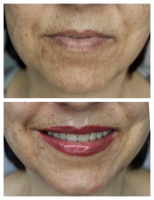 Labios micropigmentaci�n.