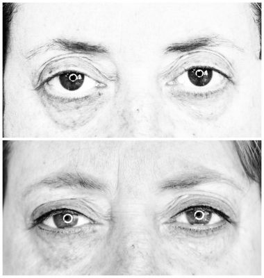 Ojos relleno de pesta�as.