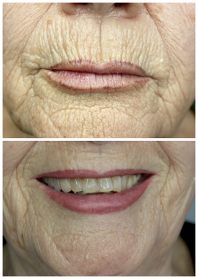 Correcci�n dise�o y color labios.