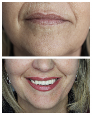 Labios correcci�n de dise�o.