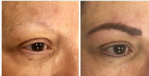 Micropigmentaci�n oncol�gica cejas.