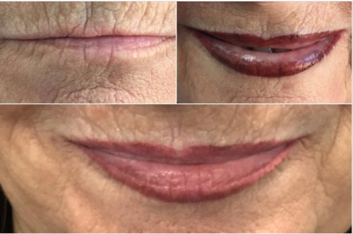 Micropigmentaci�n de labios