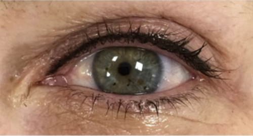 Ojos relleno de pesta�a superior