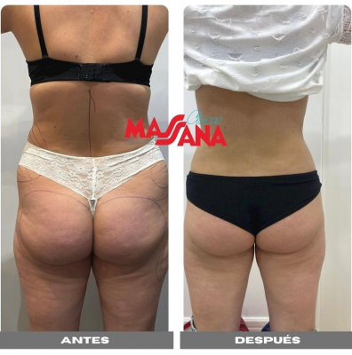 Foto Cl�nicas Massana