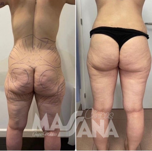 Foto Cl�nicas Massana