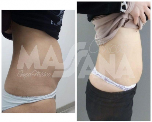 Foto Cl�nicas Massana