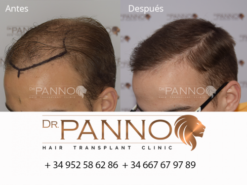 Foto Cl�nica de Trasplante Capilar Dr. Panno