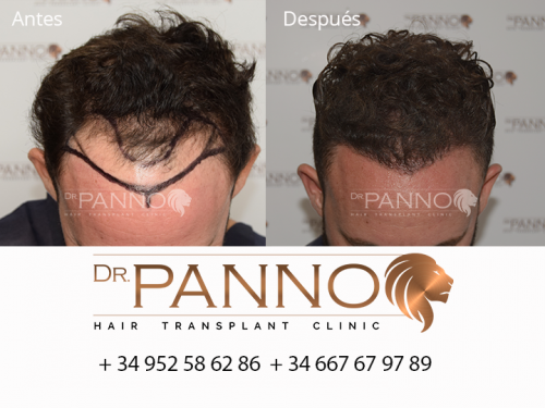 Foto Cl�nica de Trasplante Capilar Dr. Panno