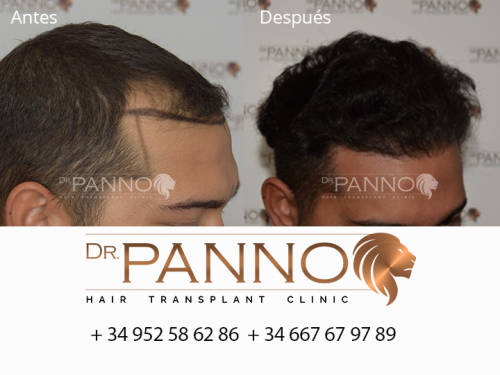 Foto Cl�nica de Trasplante Capilar Dr. Panno