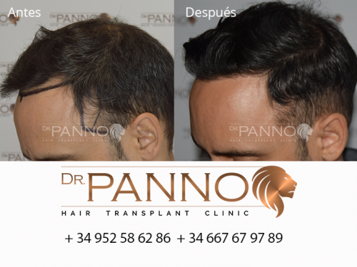 Foto Cl�nica de Trasplante Capilar Dr. Panno