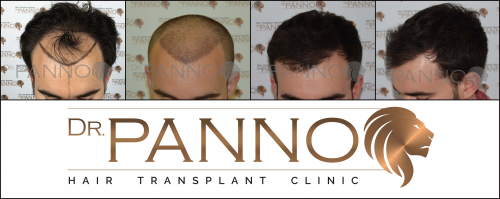 Foto Cl�nica de Trasplante Capilar Dr. Panno