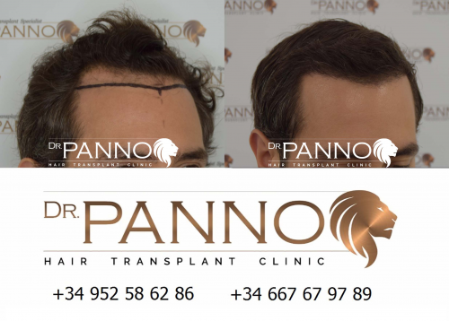 Foto Cl�nica de Trasplante Capilar Dr. Panno