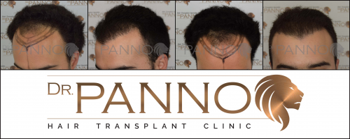 Foto Cl�nica de Trasplante Capilar Dr. Panno