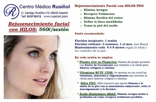 Rejuvenecimiento con hilos