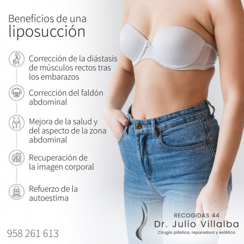 Liposucci�n Granada