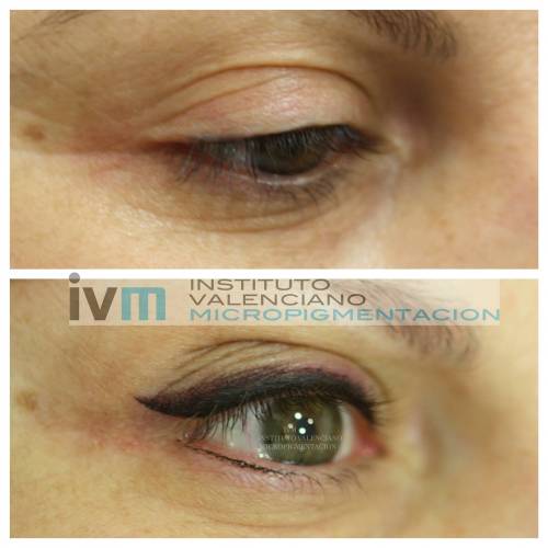 Foto INSTITUTO VALENCIANO MICROPIGMENTACION