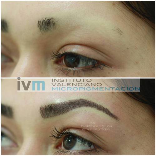 Foto INSTITUTO VALENCIANO MICROPIGMENTACION