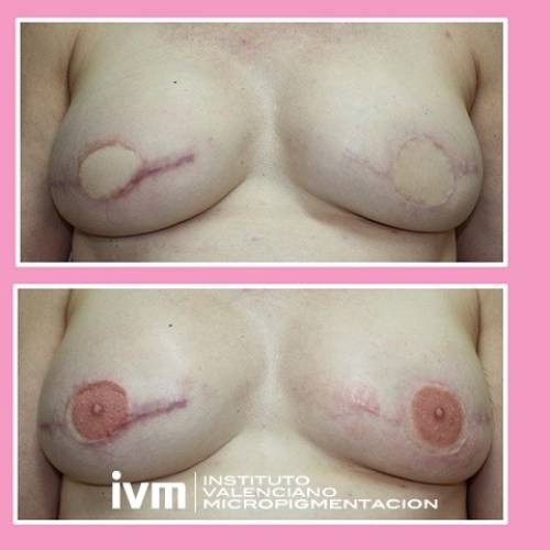 Foto INSTITUTO VALENCIANO MICROPIGMENTACION