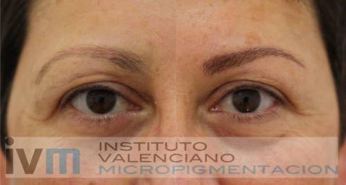 Foto INSTITUTO VALENCIANO MICROPIGMENTACION