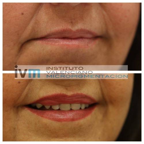 Foto INSTITUTO VALENCIANO MICROPIGMENTACION